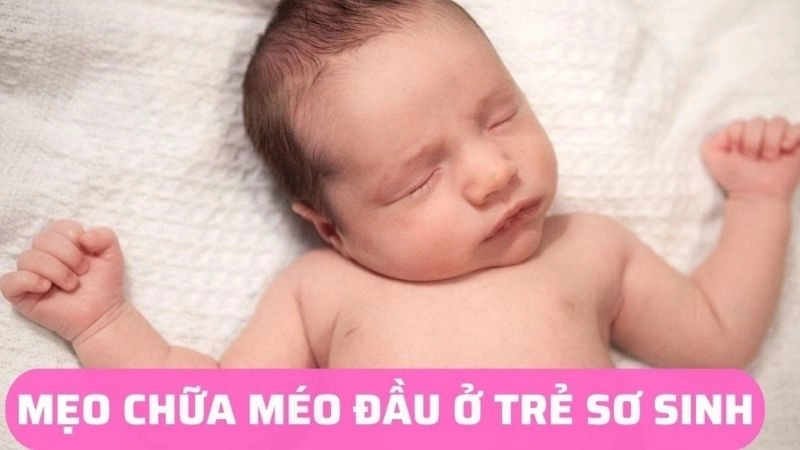 Bật mí mẹo dân gian chữa méo đầu cho trẻ sơ sinh an toàn