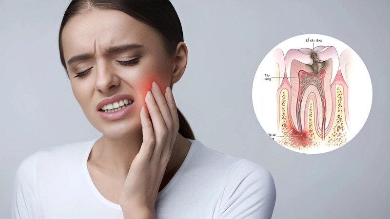 Cách điều trị và phòng ngừa áp xe hiệu quả