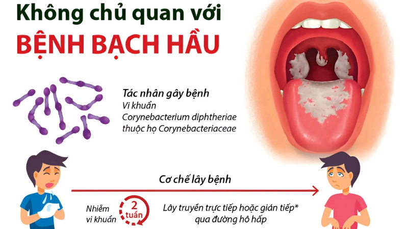 Bệnh bạch hầu là gì? Triệu chứng, nguyên nhân và cách phòng
