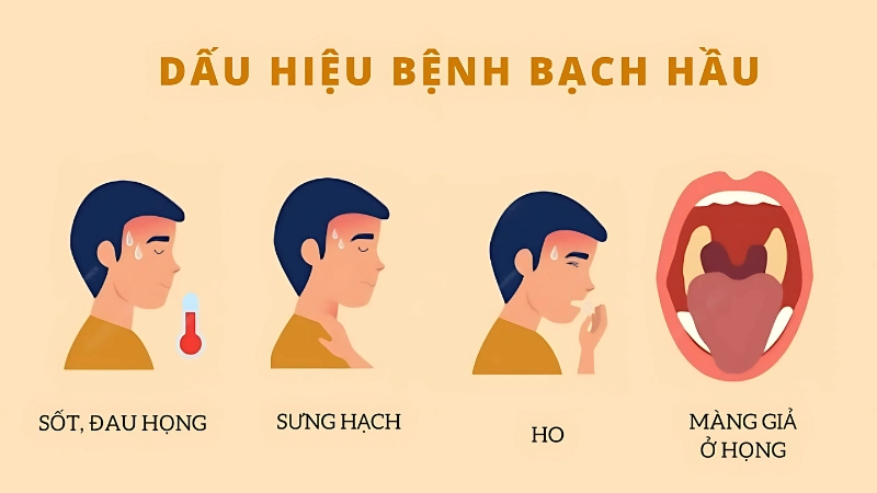 Dấu hiệu và triệu chứng bệnh bạch hầu