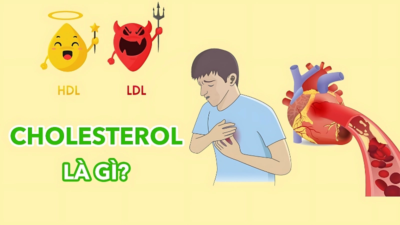 Cholesterol là gì? Cách hiểu đúng và phòng bệnh sớm