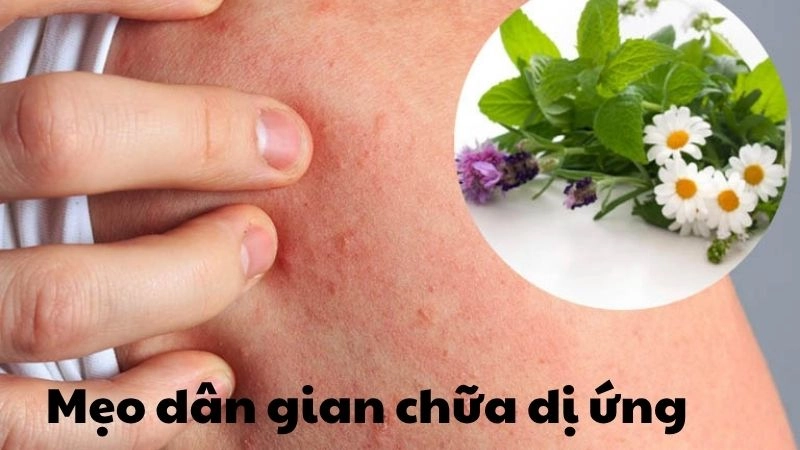 Bài thuốc dân gian chữa dị ứng khiến ai cũng bất ngờ