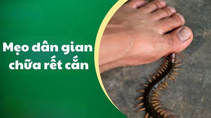 Hé lộ mẹo dân gian chữa rết cắn từ kinh nghiệm xưa