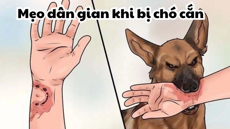 Chuyên gia mách mẹo dân gian khi bị chó cắn cấp tốc