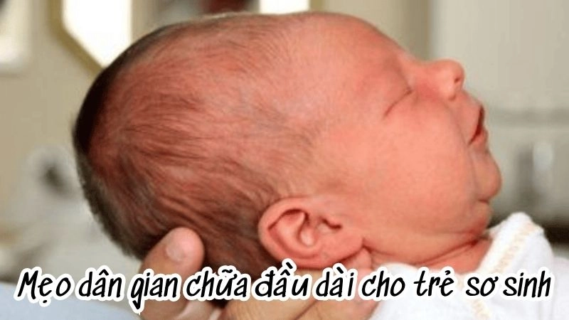 Mẹo dân gian chữa đầu dài cho trẻ sơ sinh an toàn hiệu quả