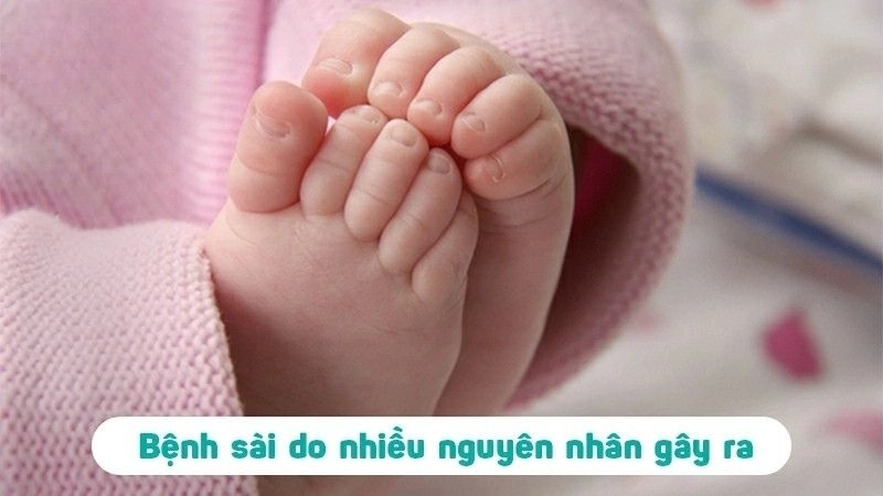 Nguyên nhân khiến trẻ bị sài cần được hiểu rõ
