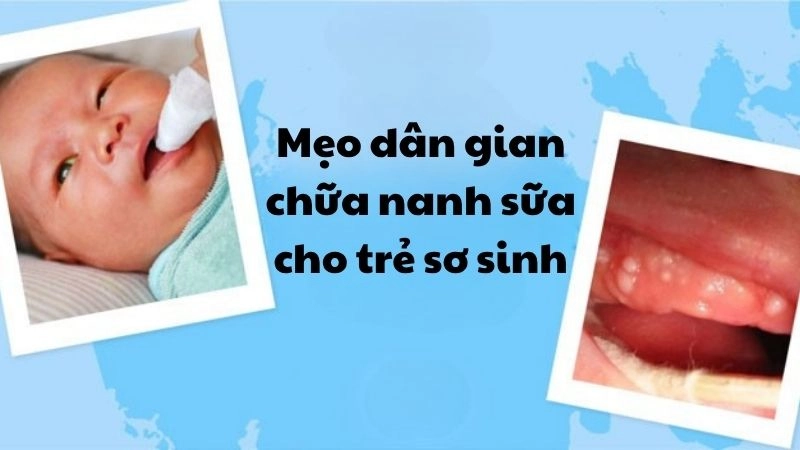 Bật mí mẹo dân gian chữa nanh sữa cho trẻ sơ sinh an toàn