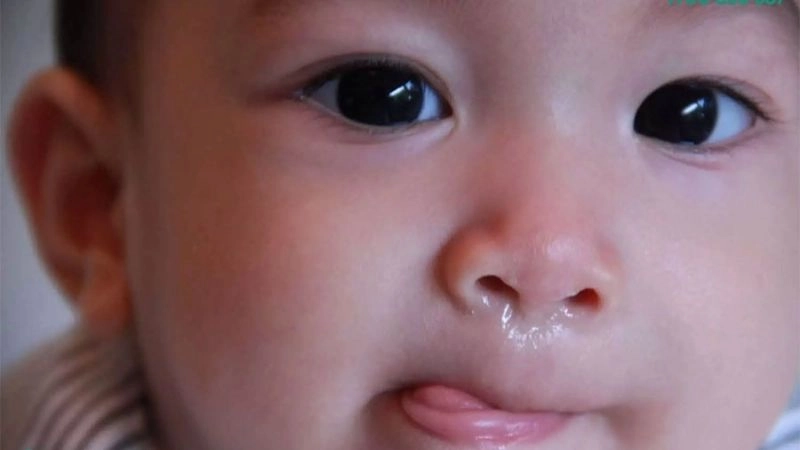6. Nguyên nhân khiến trẻ bị sổ mũi thường gặp