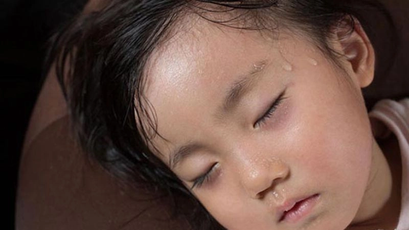 12. Khái niệm mồ hôi trộm ở trẻ và dấu hiệu nhận biết