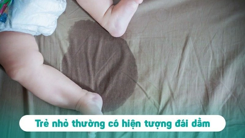 Trẻ đái dầm thường do bàng quang chưa phát triển hoàn thiện
