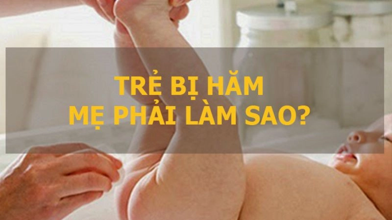 Nguyên nhân khiến trẻ bị hăm da cần lưu ý