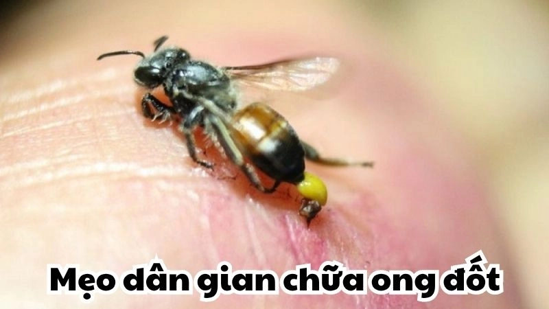 Học ngay mẹo dân gian chữa ong đốt không để lại sẹo