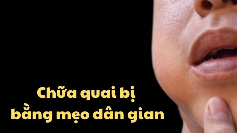 Bất ngờ với mẹo chữa quai bị dân gian lâu đời cực hiệu quả