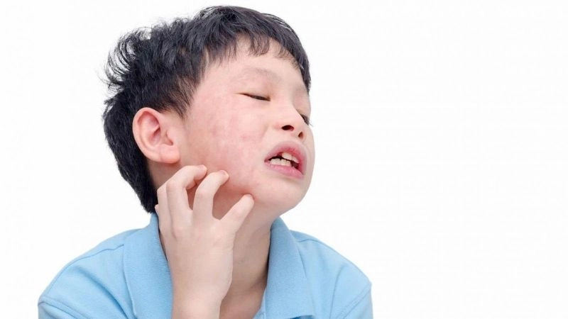 Nguyên nhân gây ra bệnh quai bị thường gặp