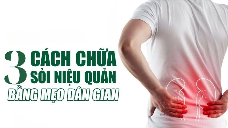 Hướng dẫn chữa sỏi niệu quản bằng mẹo dân gian an toàn