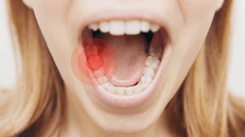 Đau răng kéo dài gây phiền toái khó chịu mọi lúc