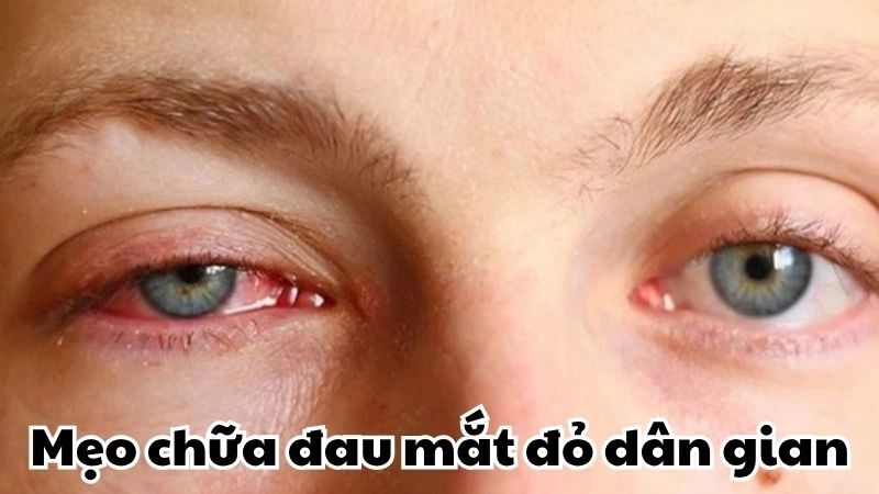 Giật mình với mẹo chữa đau mắt đỏ dân gian cực hiệu quả