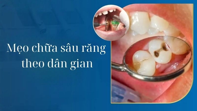 Những mẹo chữa sâu răng dân gian người xưa truyền lại