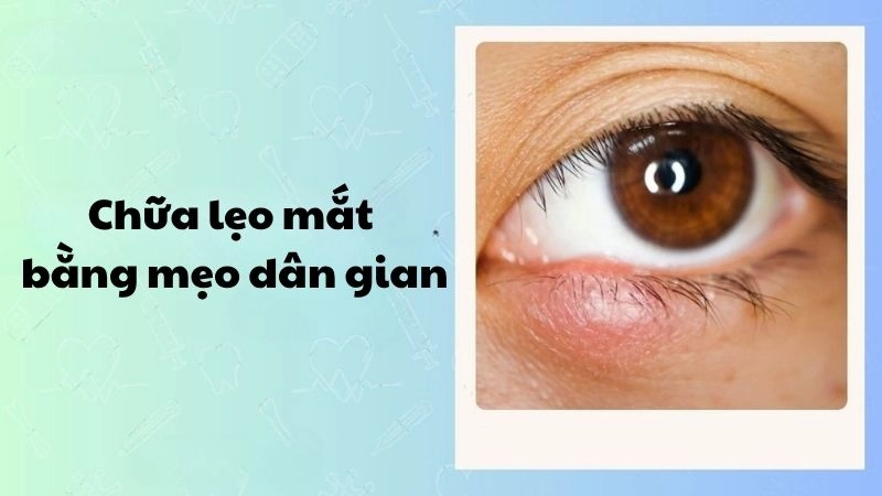 Chữa lẹo mắt bằng mẹo dân gian hiệu quả và siêu đơn giản