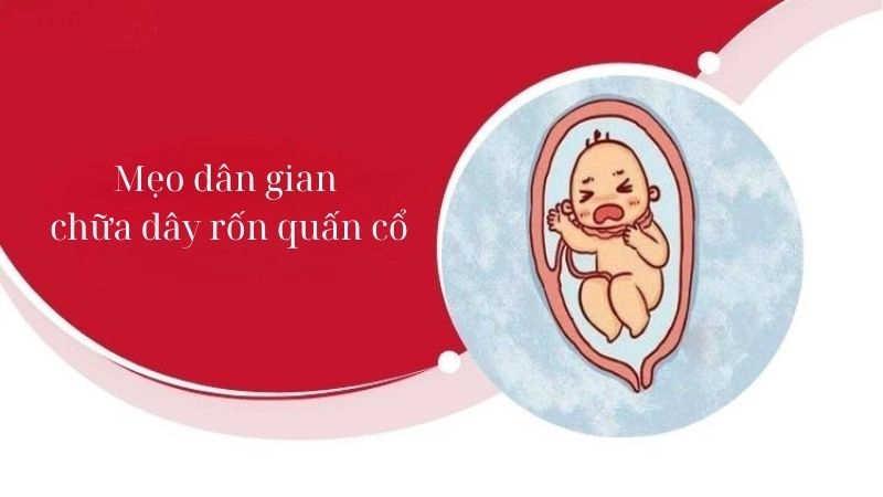 Giải mã mẹo dân gian chữa dây rốn quấn cổ ít ai ngờ tới