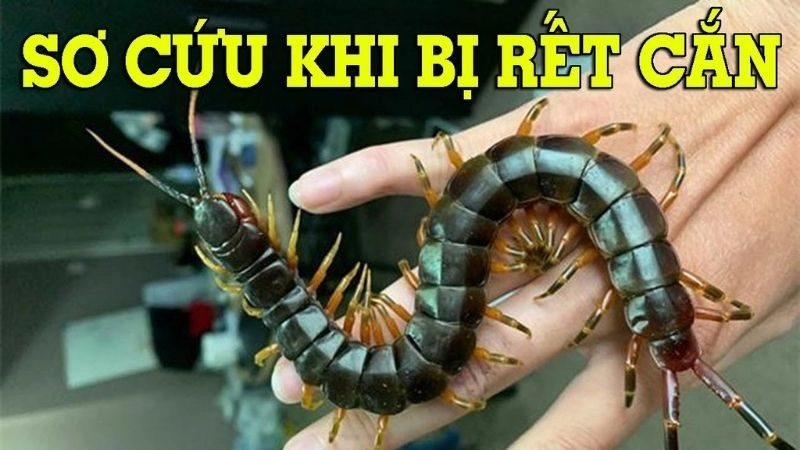 Cách sơ cứu khi bị rết cắn nhanh chóng hiệu quả