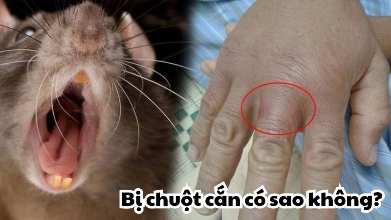 Bị chuột cắn có sao không - Đừng xem thường vết xước nhỏ