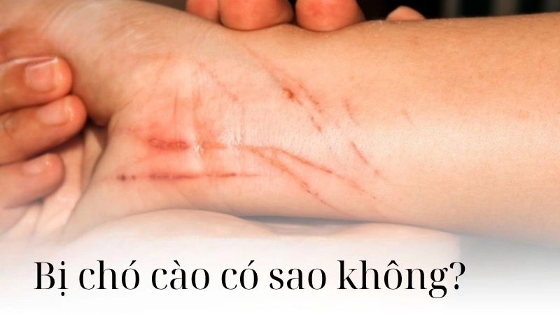 Bị chó cào có sao không - Tìm hiểu ngay để tránh biến chứng