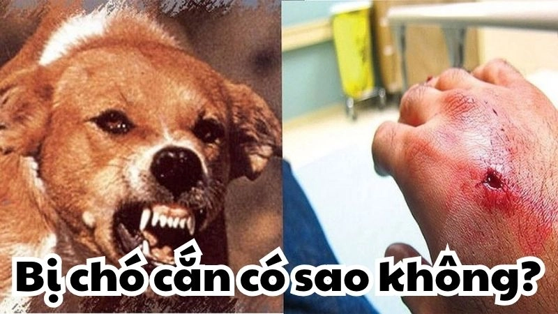 Giải mã việc bị chó cắn có sao không từ chuyên gia