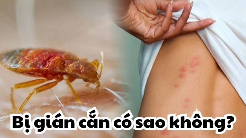 Gián cắn có sao không - Cẩn trọng hiểm họa trong bóng tối