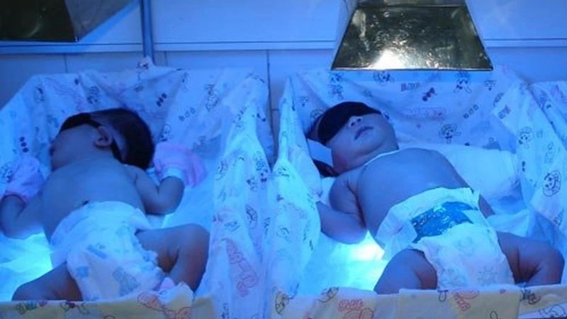 phương pháp giảm vàng da cho bé hiệu quả