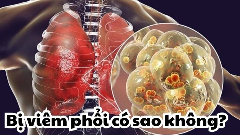 Bị viêm phổi có sao không và cách nhận biết sớm nhất