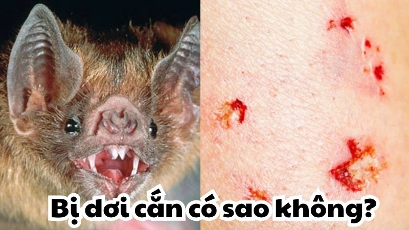 Bị dơi cắn có sao không và cách xử lý nhanh chóng nhất