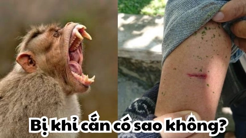Bị khỉ cắn có sao không và những điều không được bỏ qua