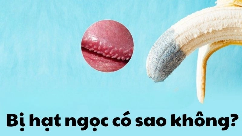 Bị hạt ngọc có sao không và những hậu quả không ngờ tới