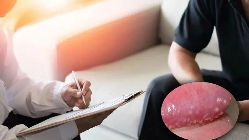 chuỗi hạt ngọc có khả năng tự giảm dần theo thời gian