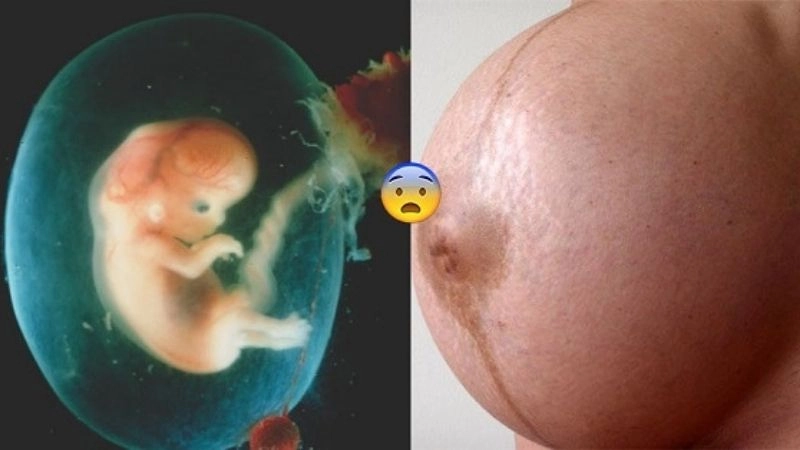 Dấu hiệu khi bị dư ối không dễ nhận ra nếu mẹ bầu thiếu kiến thức