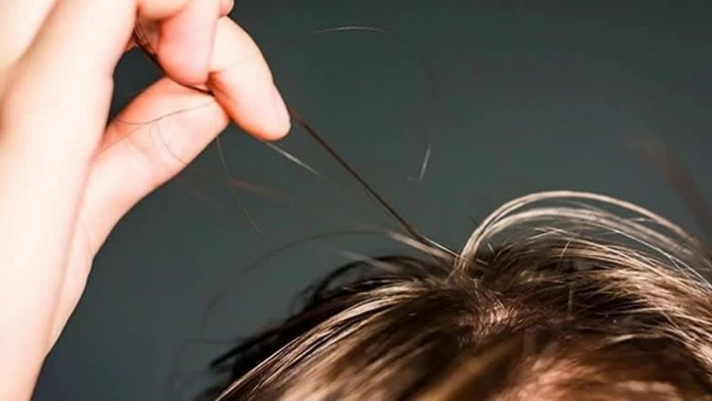 Nhận biết sớm triệu chứng hội chứng giật tóc
