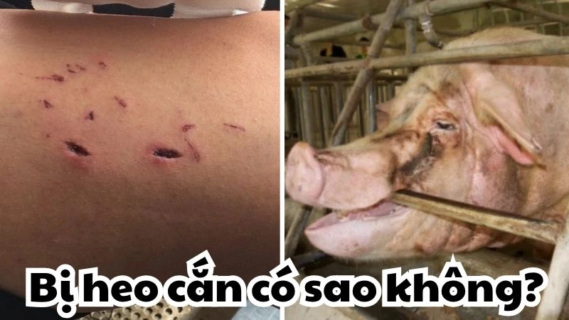 Giải mã bị heo cắn có sao không từ góc nhìn y khoa