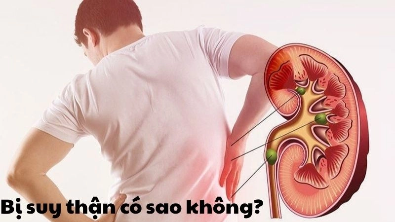 Bị suy thận có sao không và cách điều trị kịp thời