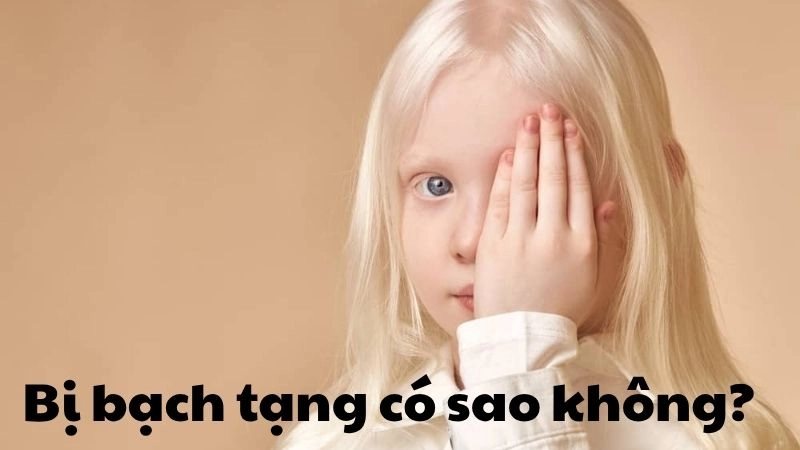 Bị bạch tạng có sao không và phương pháp cải thiện da