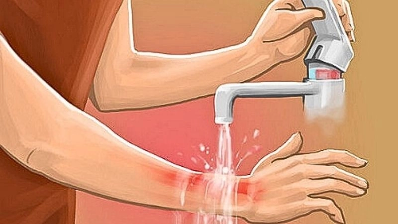 Sau khi bị khỉ cào, bạn cần rửa vết thương ngay bằng xà phòng và nước sạch 