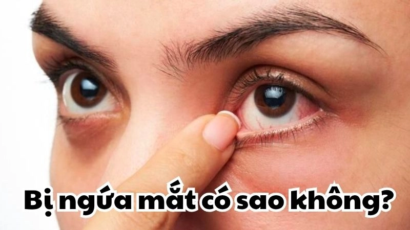 Bị ngứa mắt có sao không và dấu hiệu cảnh báo nguy hiểm