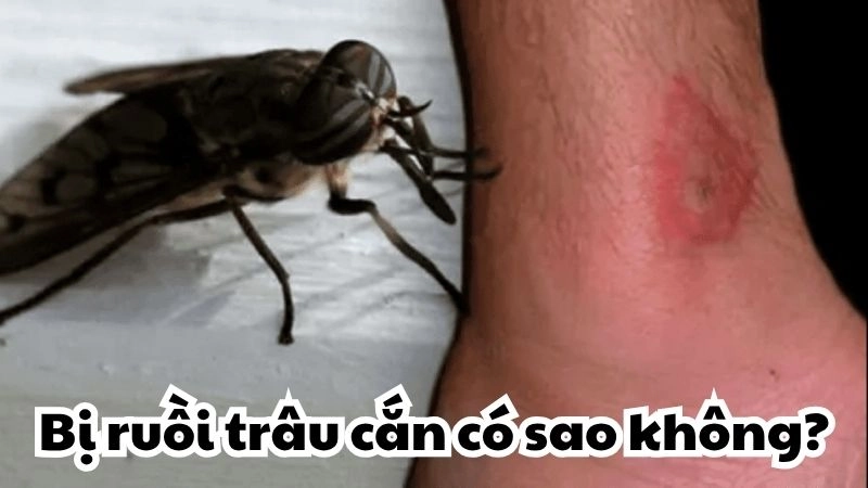 Bị ruồi trâu cắn có sao không và mối nguy tiềm ẩn khó lường
