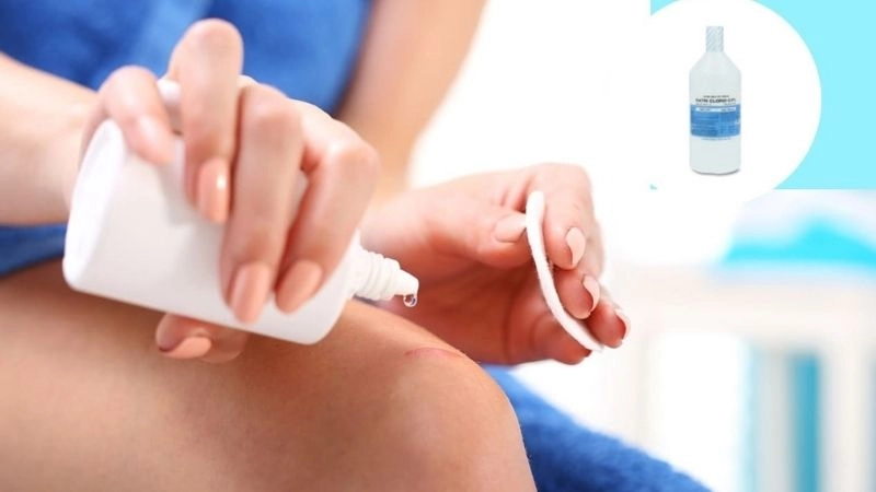 Cách xử lý khi bị ruồi trâu cắn  đúng cách