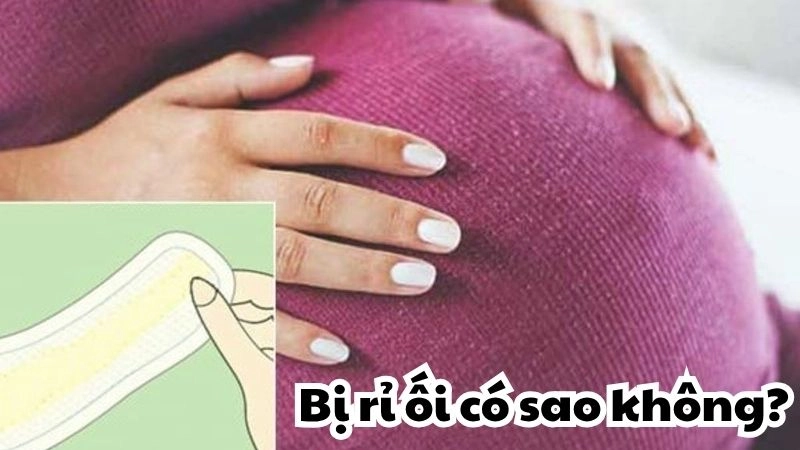 Bị rỉ ối có sao không và cách xử lý mẹ bầu cần biết