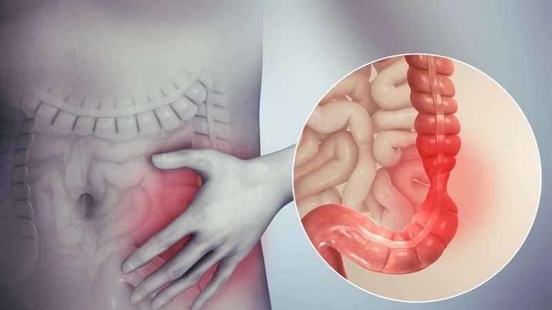 Nguyên nhân dẫn đến tiêu chảy dai dẳng