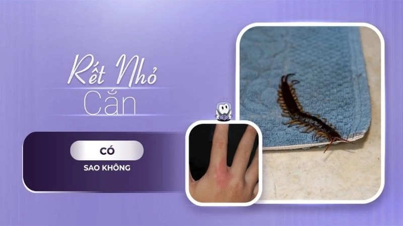 Rết nhỏ cắn có bị sao không và cách xử lý nhanh chóng