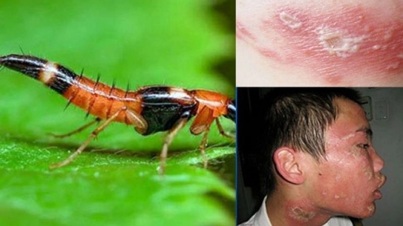 Cách xử lý khi phát hiện kiến ba khoang