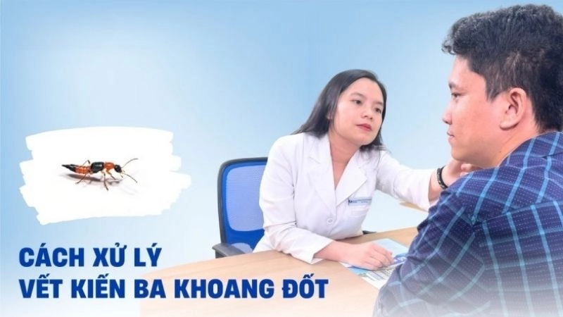 Việc cần làm ngay khi bị kiến ba khoang cắn