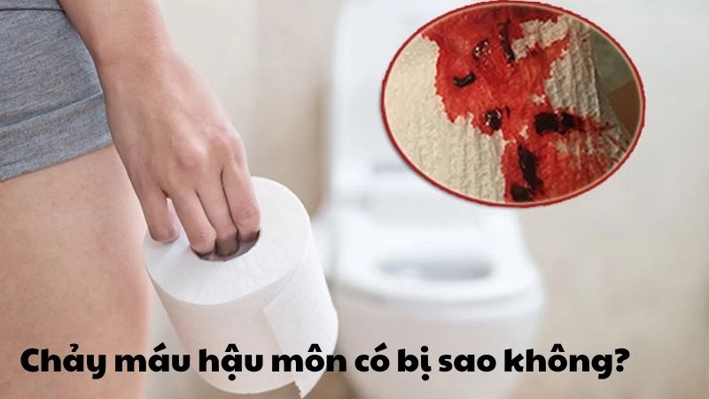 Chảy máu hậu môn có bị sao không và có nguy hiểm không